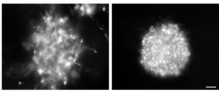 Images showing that imipramine blue inhibits the invasion and growth of glioblastoma cells in culture